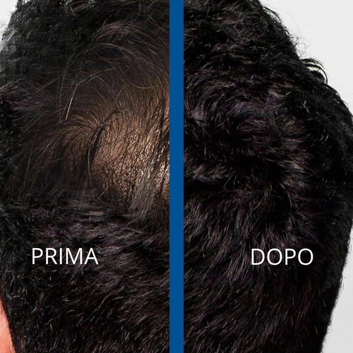 Fibre Copri Calvizie 26g - Hair Effect